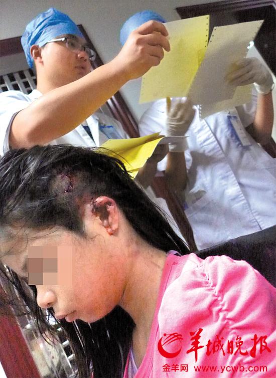 受傷的11歲女孩頭發(fā)被卷入扶梯，耳朵被嚴(yán)重拉傷，需手術(shù)。