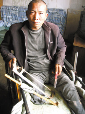 鄭艷良就是用這幾樣簡陋工具，給自己做了右腿截肢手術(shù)。