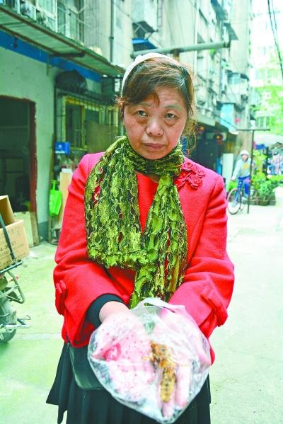 頭部受傷的黃女士展示兩根大魚刺。