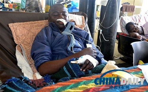 雖然已經(jīng)在醫(yī)院接受了近一個月的恢復(fù)治療，卡托卡的身體仍然非常虛弱。