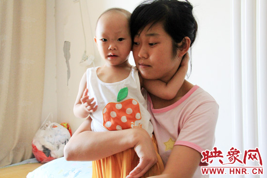 孩子和媽媽在一起，她的右眼已經(jīng)失明。