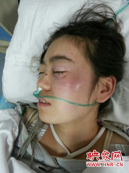 9月10日晚,被暴打的小陳出現(xiàn)了間歇性昏迷,被送進(jìn)了省人民醫(yī)院。
