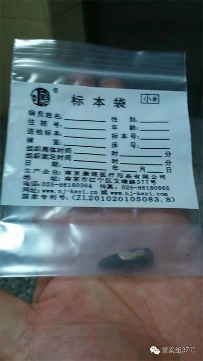 經(jīng)警方鑒定，秦女士體內取出的子彈系56式步槍射出 。 受訪者供圖