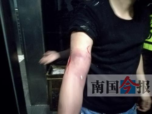 覃先生手臂被卡的部位受傷流血，所幸傷勢無大礙。 通訊員 王建民 攝