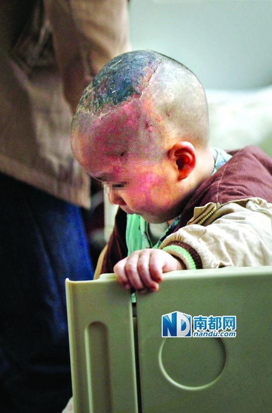 1月8日下午，小寶頭上和臉上都是傷痕。
