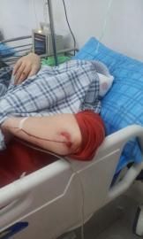 砸窗當(dāng)事人胡女士在醫(yī)院接受治療。