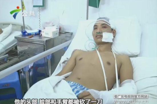 另一名傷者頭部、臉部和手臂都被砍了一刀。(視頻截圖)