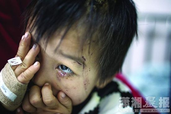 1月13日，湖南省兒童醫(yī)院，4歲的源源用手蒙住了眼睛。