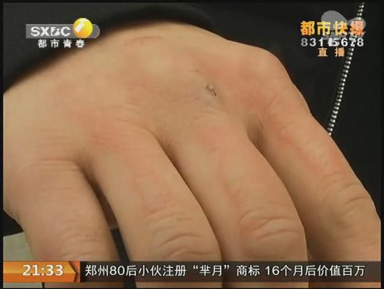 說到這足療拔罐，估計大伙都不陌生，但是想起4號晚上的拔罐的經(jīng)歷，呂先生現(xiàn)在想起來，還心有余悸。