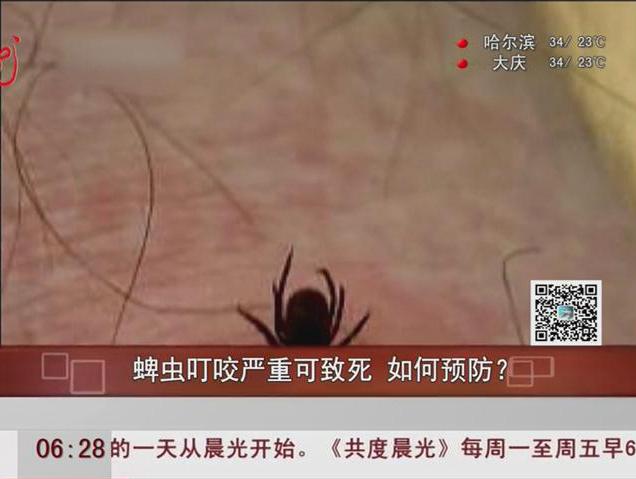 蜱蟲叮咬嚴(yán)重可致死如何預(yù)防？